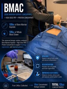 📢 Patient Driven Bone Marrow Therapy At Colorado Pain Care we recently treated a patient who came in with a strong interest in reg…